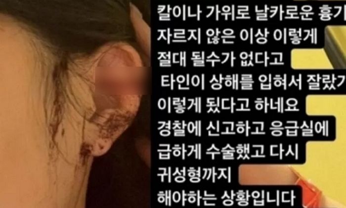 강남 클럽서 귀 짤렸다는 여성 사건 CCTV 확인한 클럽이 내놓은 새로운 주장