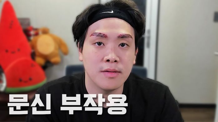 ‘135만 유튜버’ 오킹, ‘눈썹 문신’ 후 부작용 호소...“눈썹이 빨개졌다” (영상)