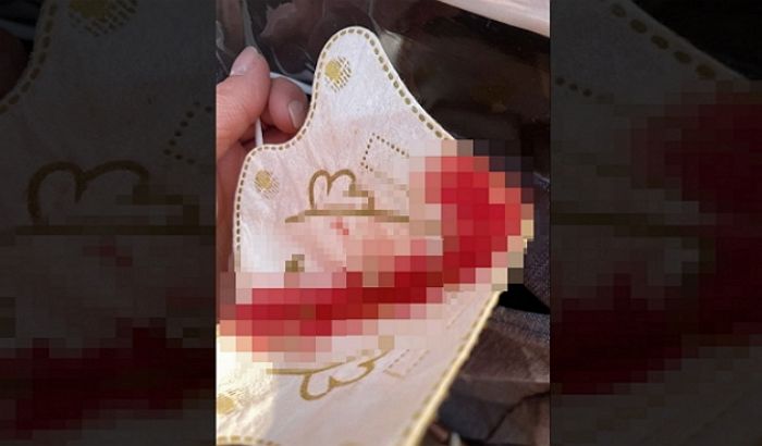 PCR 검사 받은 5살 아이 컥컥대며 울길래 봤더니...“입·코가 피로 흥건해”