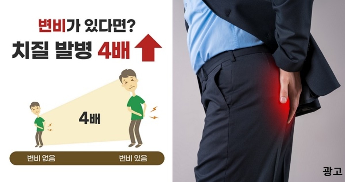 변비로 고생하고 있다면 치질을 의심해 봐야 하는 이유