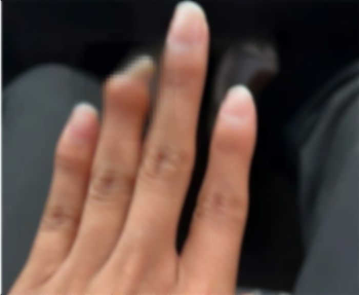 “손가락이 절단됐는데 신검서 ‘3급’ 판정 받아 현역 입대 할 뻔 했습니다”