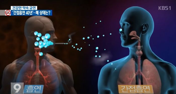 40년 간 간접흡연에 노출된 ‘비흡연자’의 망가진 폐 상태