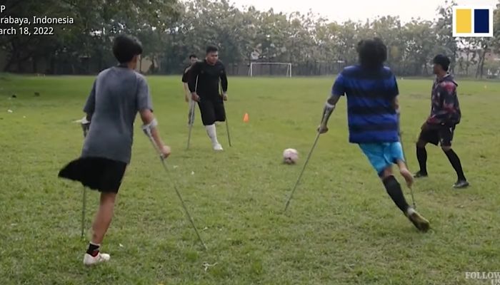 다리 한 쪽 없는데도 ‘축구선수’ 꿈 이루기 위해 목발 짚고 필드 뛰는 장애인 선수들 (영상)