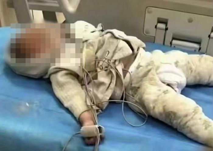 PCR 음성 검사 결과지 없다며 목에 이물질 걸린 1살 아기 진료거부해 죽게 만든 중국 의사