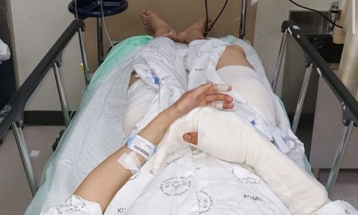 “고3인 제 친구가 흉기 든 08년생 중학생 제압하려다가 양팔을 못 쓰게 됐습니다”