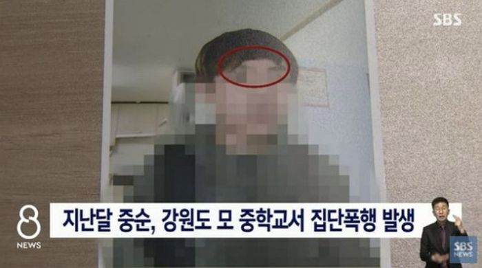 교실서 강제로 머리카락 잘리고 ‘집단 폭행’ 당했는데 ‘애들 장난’이라는 교사