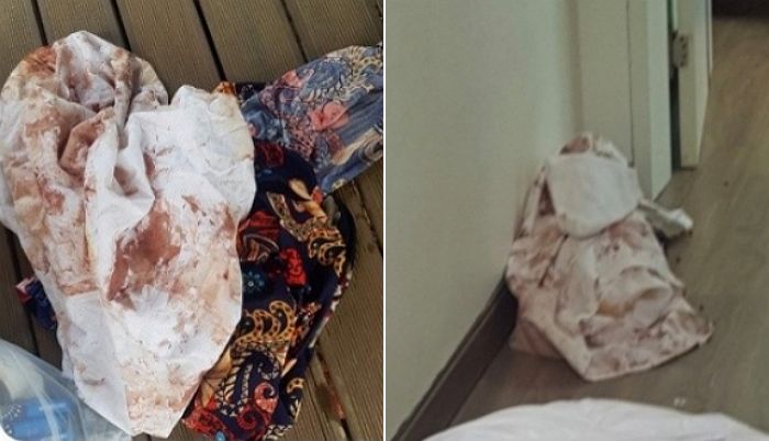 펜션 침구 ‘피범벅 ’만들어놓고 사과도 안 하고 퇴실한 커플