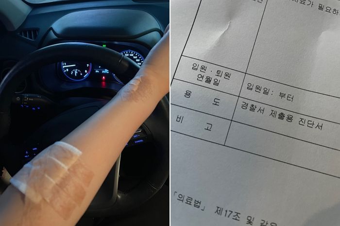 “저희 동네에 촬영하러 온 드라마 PD에 폭행 당했습니다”...방송사 갑질 폭로한 20대 여성