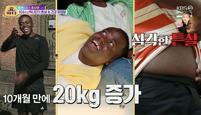 10개월 만에 ‘20kg’ 늘어나 고도비만 된 ‘콩고왕자’ 조나단 (사진)