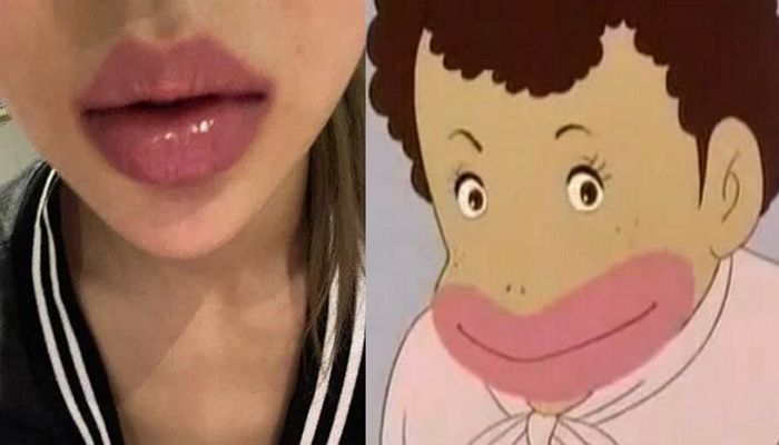 ‘달려라 하니’ 캐릭터 프사했다가 외국 팬들에 “흑인 인종차별” 지적받은 여돌