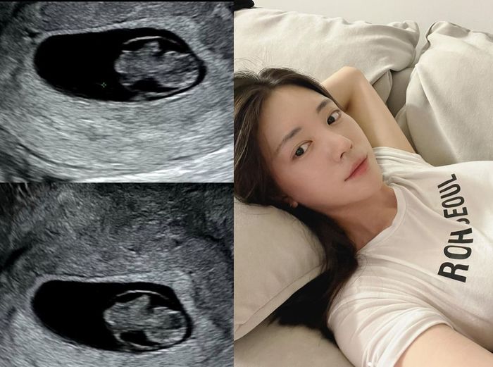 ‘얼짱’ 유혜주, 결혼 3년 만에 임신 발표...“입덧 힘들지만 즐거워”