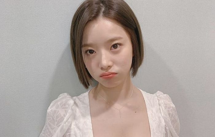 “너무 아파 울다가 자”...임신 고백 후 컨디션 난조 호소한 가수 벤