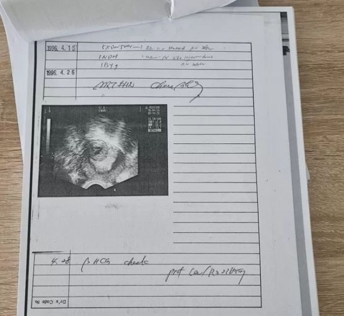 엉뚱한 남자 정자 인공수정 해놓고 혈액형 다르자 ‘돌연변이’ 주장한 의사