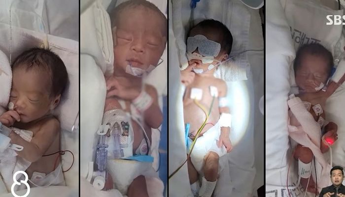 “국내 최초”....자연분만으로 귀여운 네쌍둥이 남매 낳은 엄마