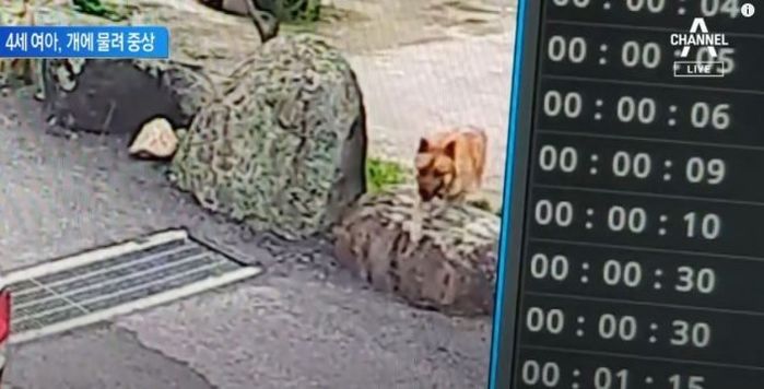 ‘대형견’ 개물림 사고 또 일어났네요...이번에는 4살 여자아이가 당했습니다
