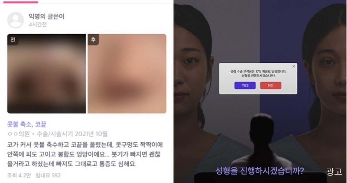 “부작용 후기에 병원 이름 공개하면 명예훼손?” 바비톡, 업계 최초 실제 ‘병원명’ 공개