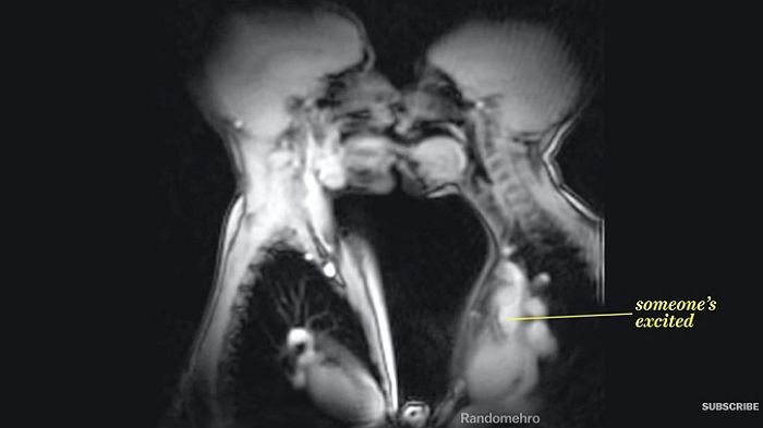 트위터에 올라온 ‘키스하는 커플’ MRI 영상 풀버전의 정체