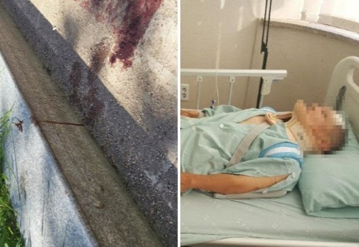 행인 ‘목뼈·두개골’ 부수고 도망친 신도림역 ‘킥보드 뺑소니범’ 잡혔는데...나이가 놀랍습니다