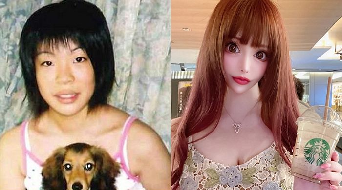 프랑스인 되고 싶어 ‘전신성형’에 30억 쓴 일본 여성의 근황