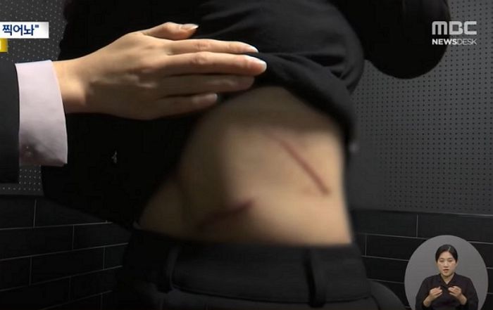 “감히 재결합 안해?”... 전부인 찾아가 흉기로 찌른 파주 육군 간부 (CCTV 영상)