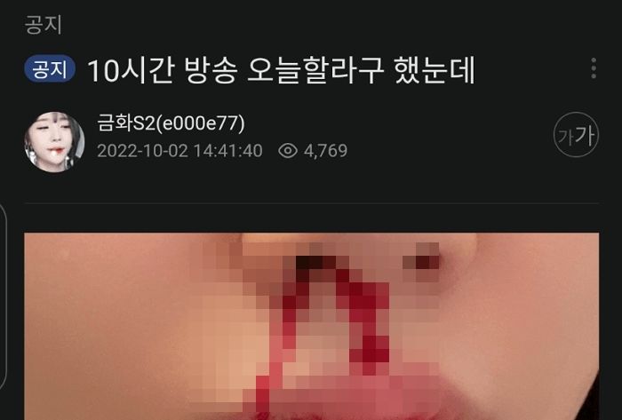 “코피가...” 아프리카 3대 여캠 BJ, 진짜 충격적인 ‘휴방 공지’ 사진 올렸다