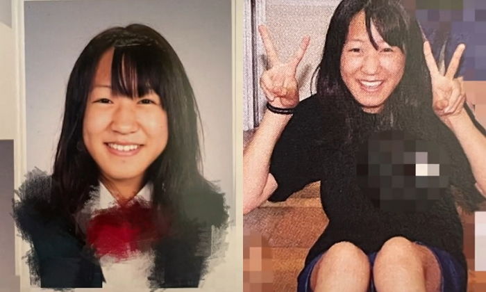 성형수술에 1억 썼는데 인생 역전했다며 대만족한 여성이 공개한 비포·애프터 사진