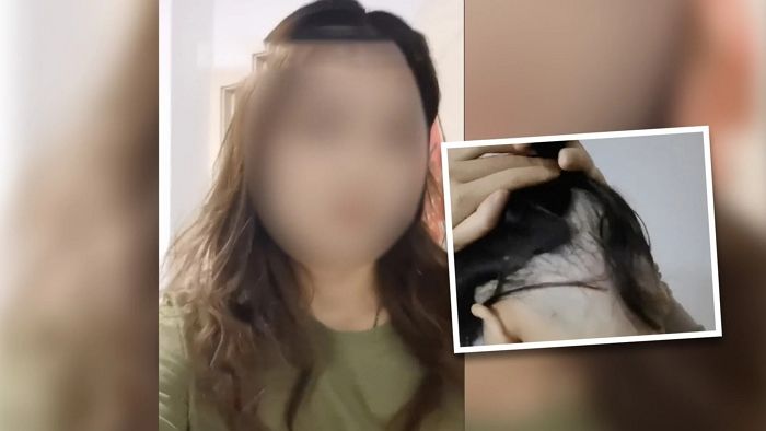 “헤어모델 해줬더니 뒷머리 빡빡 밀렸습니다” 사연에 쏟아진 충격적인 제보들