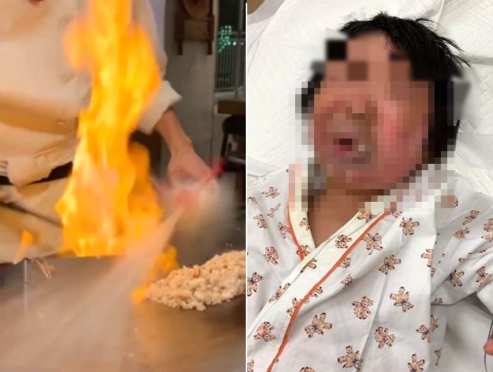 ‘불쇼’ 하다가 술 뿌리는 방향 실수해 손님들 얼굴에 불붙인 철판구이 식당 (영상)