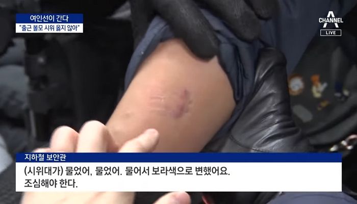 “좀비 사태 따로없다”...전장연 시위대에게 물려 시퍼렇게 멍든 지하철 보안관의 팔 상태