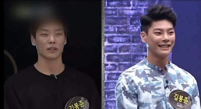 ‘렛미인’ 남성 출연자가 성형 후 월 2천 번 비결...“잘생겨서 나쁠 것 없어요” (영상)