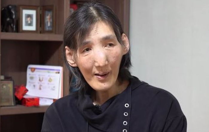 36년 투병생활한 ‘비운의 농구스타’ 김영희, 빈소도 없이 떠난다