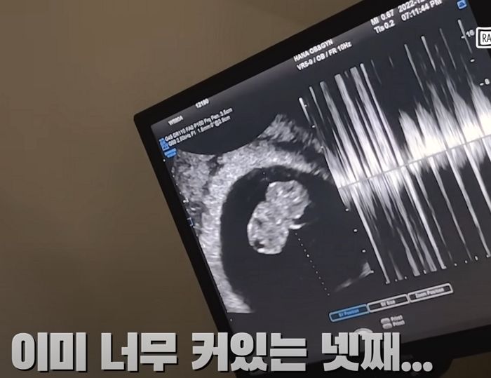 둘째 하늘나라 갔는데...기적처럼 ‘넷째 천사’ 맞이한 비글부부