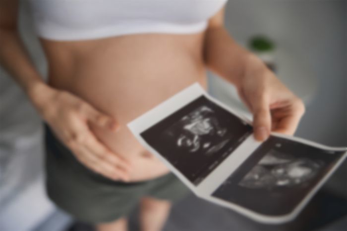 유산한 친구가 회사 일주일 쉰다고 하자 “꿀 빠네”라고 말한 여성