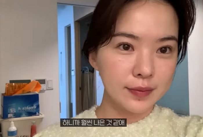 ‘쌍커풀 수술’ 2일차 만에 붓기 싹 빠진 유튜버 하늘, 팬들 부러움 폭발했다