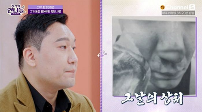 ‘자산 27억’ 환경미화원 “무장 강도 만나 코·팔 잘려” 충격 고백