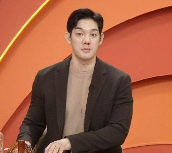 KBS 생방송 도중 ‘코피’ 쏟은 박재민이 직접 공개한 현재 건강 상태