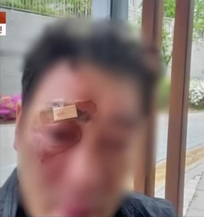 “표정이 예의 없어”...관리소 직원 말대꾸했다고 얼굴에 가스총 쏜 입주민 (영상)