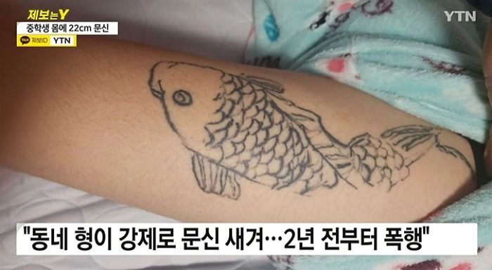인천 10대, 또래 중학생 후배 위협해 허벅지에 강제로 20cm ‘잉어 문신’ 새겨