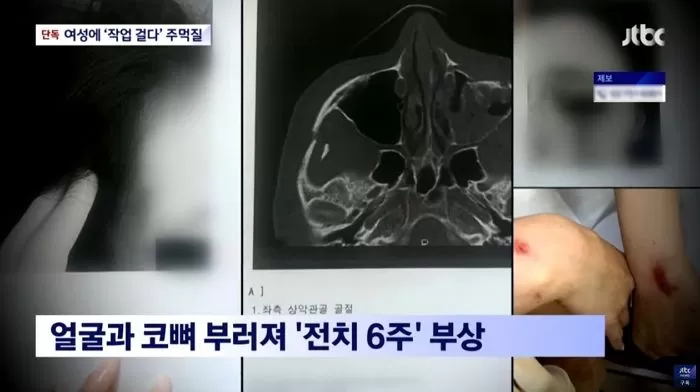 인사이트