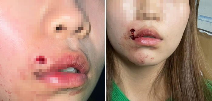 “23살 딸이 대전 거리 한복판에서 30대 남성들에게 정신을 잃을 정도로 폭행을 당했습니다”