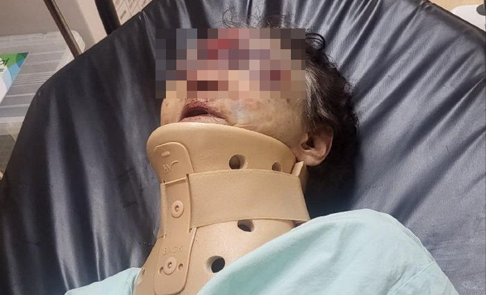 “치매로 실종됐던 할머니가 폭행당해...양주시 유양삼거리 목격자 찾습니다”