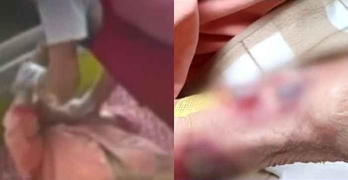 기저귀 갈며 팔 누르고 비튼 요양사...숨지기 전 노인은 “경찰 불러달라” 호소했다