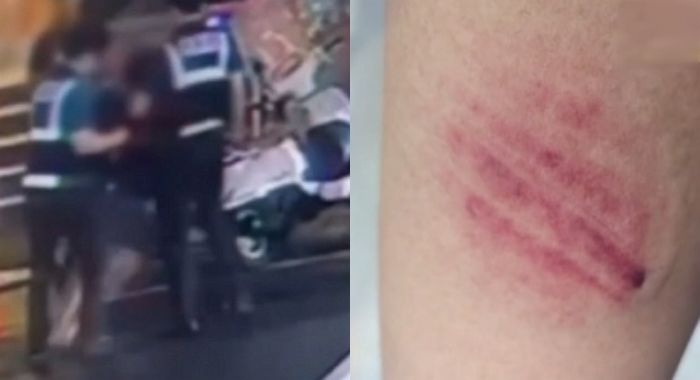 강남 한복판서 만취해 난동 부리다 경찰 팔까지 물어뜯은 ‘핵이빨’ 중학생 (+영상)