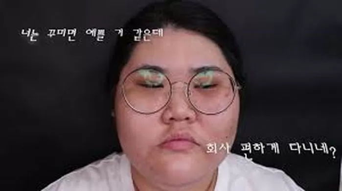 몸무게 쫙 빠진 듯한 ‘그림자’ 사진 올리며 2년 만에 근황 공개한 ‘탈코르셋’ 배리나