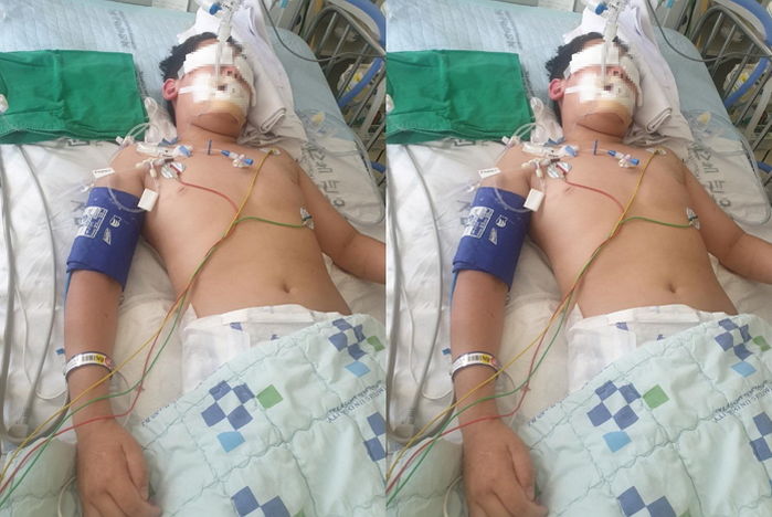 “초등 5학년 아들이 유도 학원에서 운동하다 뇌출혈 상태로 돌아왔습니다”