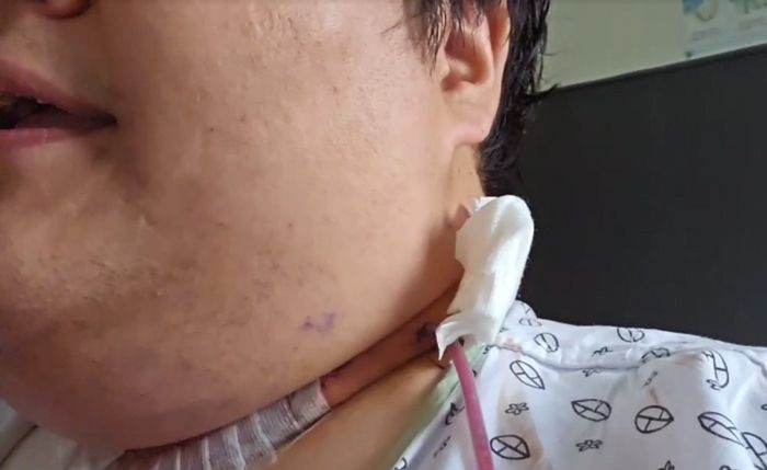 ‘갑상샘 암’ 투병하는 공혁준 “암, 목 다른 부위에도 전이됐다”