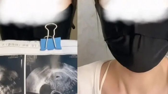 여친이 임신 고백하자 몰래 ‘낙태약’ 섞은 음료수 먹인 남친