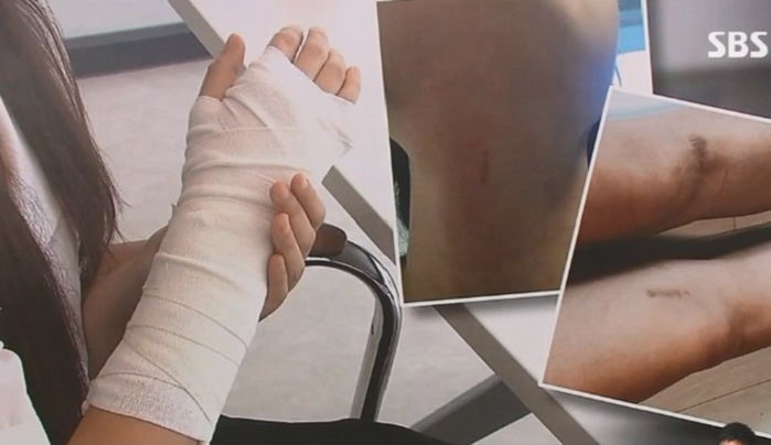 6학년 남학생에게 폭행 당한 담임 여교사..“학생들 앞에서 욕하고 발로 밟아”