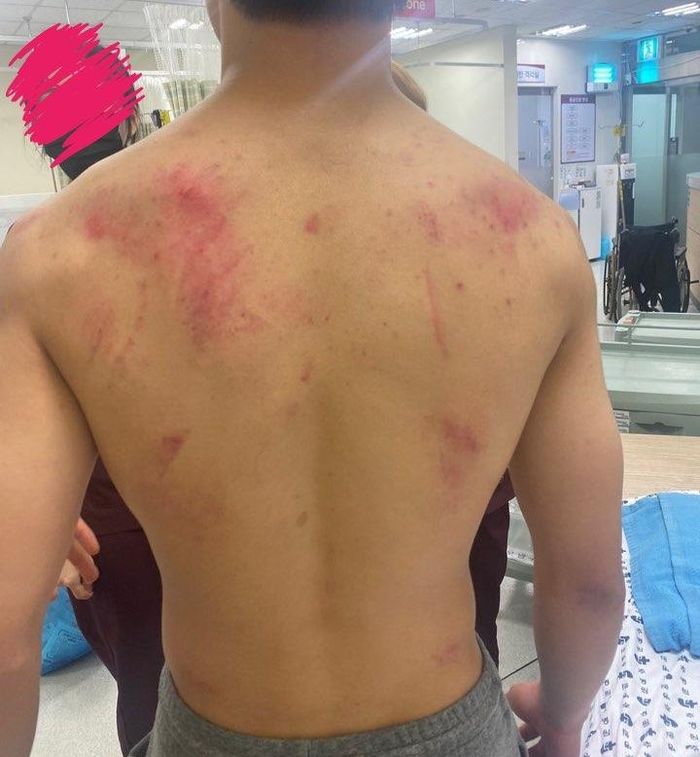 ‘의정부 칼부림 난동범’으로 오해받아 경찰한테 두들겨 맞은 중3 소년 몸상태 (+사진)