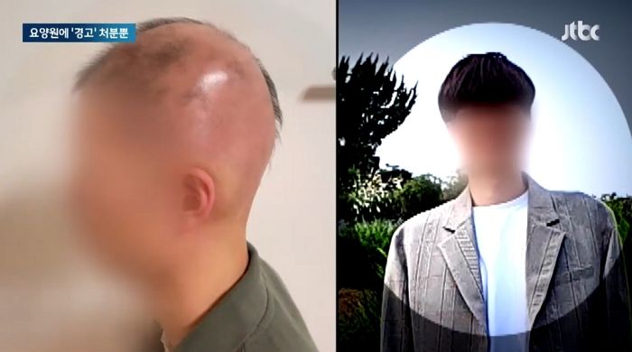 요양원서 근무하던 공익 ‘전체 탈모’...과도한 업무 호소에도 ‘공무상 질병’ 인정 안 돼